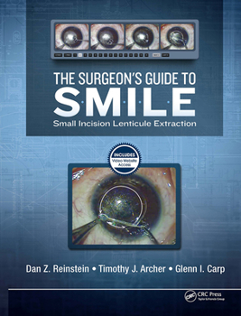 Hardcover The Surgeon's Guide to SMILE: Small Incision Lenticule Extraction Book