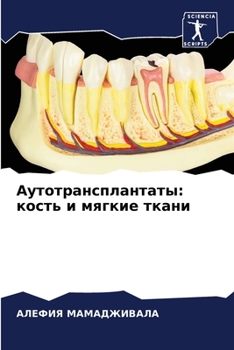 Paperback Аутотрансплантаты: кост& [Russian] Book
