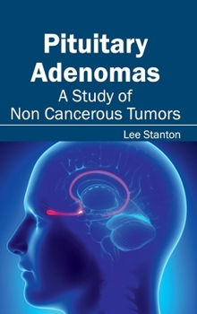 Hardcover Pituitary Adenomas: A Study of Non Cancerous Tumors Book