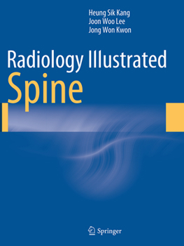 Paperback Radiology Illustrated: Spine Book