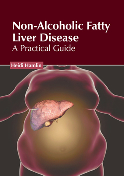 Hardcover Non-Alcoholic Fatty Liver Disease: A Practical Guide Book