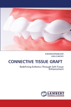 Paperback Connective Tissue Graft Book