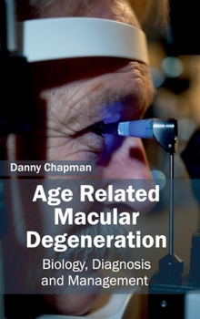 Hardcover Age Related Macular Degeneration: Biology, Diagnosis and Management Book