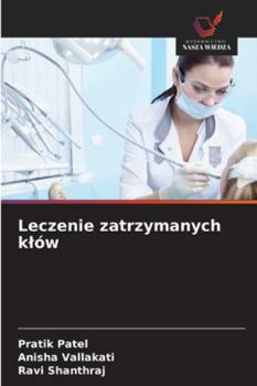 Paperback Leczenie zatrzymanych klów [Polish] Book