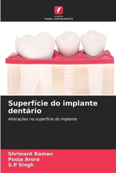 Paperback Superfície do implante dentário [Portuguese] Book
