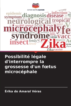 Paperback Possibilité légale d'interrompre la grossesse d'un foetus microcéphale [French] Book