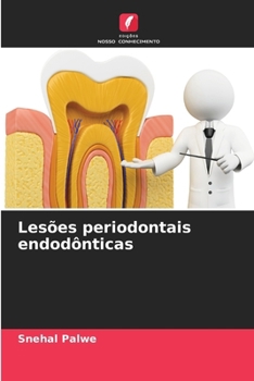 Paperback Lesões periodontais endodônticas [Portuguese] Book
