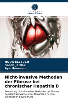 Paperback Nicht-invasive Methoden der Fibrose bei chronischer Hepatitis B [German] Book
