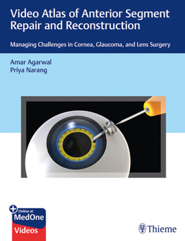 Paperback Video Atlas of Anterior Segment Repair and Reconstruction: Managing Challenges in Cornea, Glaucoma, and Lens Surgery Book