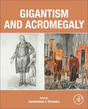 Paperback Gigantism and Acromegaly Book