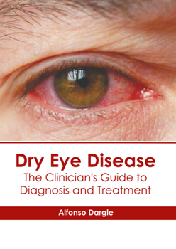 Hardcover Dry Eye Disease: The Clinician's Guide to Diagnosis and Treatment Book