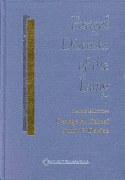 Hardcover Fungal Diseases of the Lung Book