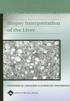 Hardcover Biopsy Interpretation of the Liver [With CDROM] Book