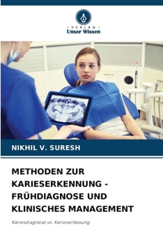 Paperback Methoden Zur Karieserkennung - Frühdiagnose Und Klinisches Management [German] Book