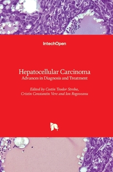 Hardcover Hepatocellular Carcinoma: Advances in Diagnosis and Treatment Book