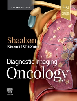 Hardcover Diagnostic Imaging: Oncology Book