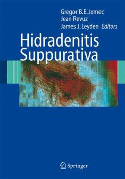 Paperback Hidradenitis Suppurativa Book