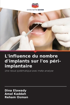 Paperback L'influence du nombre d'implants sur l'os péri-implantaire [French] Book