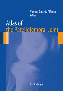Paperback Atlas of the Patellofemoral Joint Book