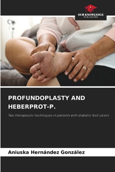 Paperback Profundoplasty and Heberprot-P. Book