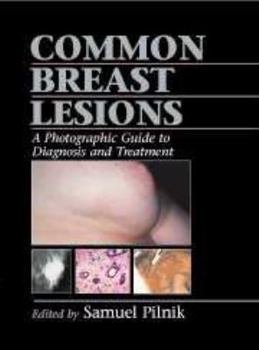 Common Breast Lesions: A Photographic Guide to Diagnosis and Treatment