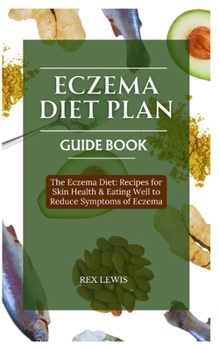 Paperback Eczema Diet Plan Guide Book: The Eczema Diet: Recipes for Skin Health & Eating Well to Reduce Symptoms of Eczema Book