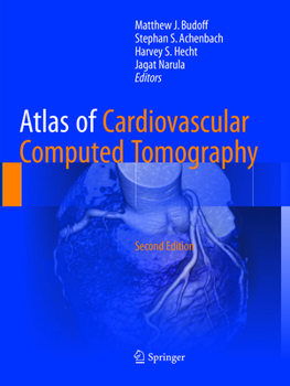 Paperback Atlas of Cardiovascular Computed Tomography Book