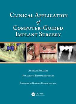 Hardcover Clinical Application of Computer-Guided Implant Surgery Book