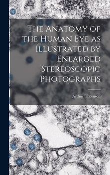 Hardcover The Anatomy of the Human eye as Illustrated by Enlarged Stereoscopic Photographs Book
