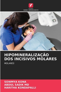 Paperback Hipomineralização DOS Incisivos Molares [Portuguese] Book