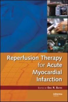 Hardcover Reperfusion Therapy for Acute Myocardial Infarction Book