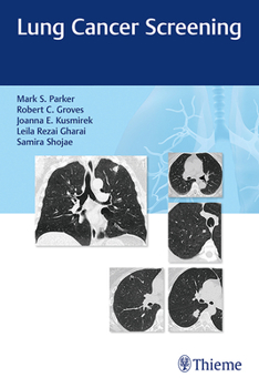 Paperback Lung Cancer Screening Book