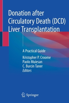 Paperback Donation After Circulatory Death (DCD) Liver Transplantation: A Practical Guide Book