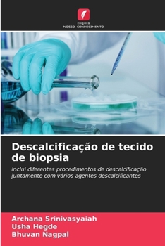 Paperback Descalcificação de tecido de biopsia [Portuguese] Book