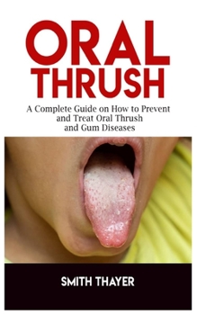Oral Thrush: A Complete Guide on How to Prevent and Treat Oral Thrush and Gum Diseases