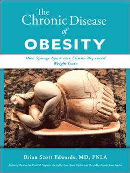 Paperback The Chronic Disease of Obesity: How Sponge Syndrome Causes Repeated Weight Gain Book