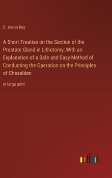 Hardcover A Short Treatise on the Section of the Prostate Gland in Lithotomy; With an Explanation of a Safe and Easy Method of Conducting the Operation on the P Book