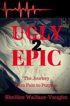 Paperback Ugly 2 Epic: The Journey from Pain to Purpose Book