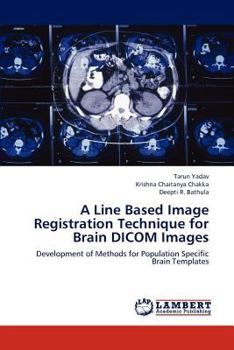 Paperback A Line Based Image Registration Technique for Brain Dicom Images Book