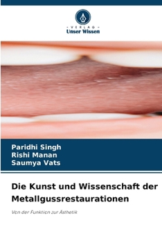 Die Kunst und Wissenschaft der Metallgussrestaurationen (German Edition)