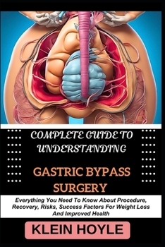 COMPLETE GUIDE TO UNDERSTANDING GASTRIC BYPASS SURGERY: Everything You Need To Know About Procedure, Recovery, Risks, Success Factors For Weight Loss And Improved Health