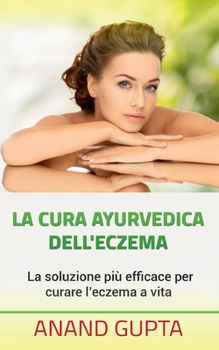 Paperback La cura ayurvedica dell'eczema: La soluzione più efficace per curare l'eczema a vita [Italian] Book