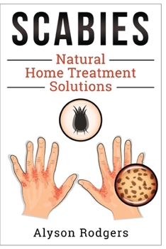 Paperback Scabies Natural Home Treatment Solution Book