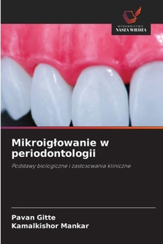 Paperback Mikroiglowanie w periodontologii [Polish] Book