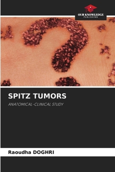 Paperback Spitz Tumors Book