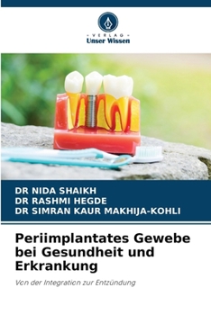 Periimplantates Gewebe bei Gesundheit und Erkrankung (German Edition)