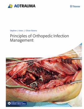Hardcover Principles of Orthopedic Infection Management Book