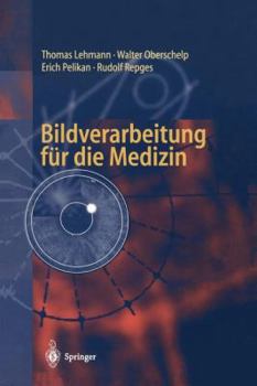 Paperback Bildverarbeitung Für Die Medizin: Grundlagen, Modelle, Methoden, Anwendungen [German] Book
