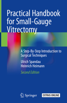 Hardcover Practical Handbook for Small-Gauge Vitrectomy: A Step-By-Step Introduction to Surgical Techniques Book