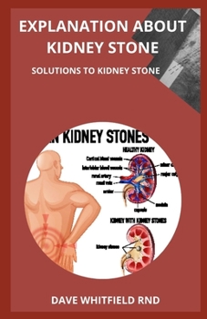 Paperback Explanation about Kidney Stone: Solutions to Kidney Stone Book